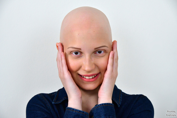 Alopecia - Photo credits @Anesis_Kornezos