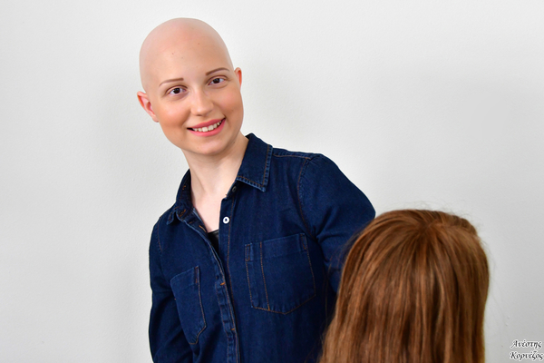 Alopecia - Photo credits @Anesis_Kornezos
